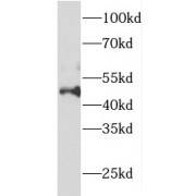 WB analysis of human heart tissue, using FOXO4 antibody (1/800 dilution).