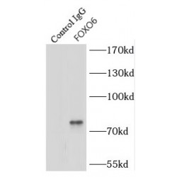 Forkhead Box Protein O6 (FOXO6) Antibody
