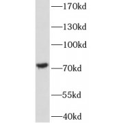 WB analysis of mouse brain tissue, using FOXO6 antibody (1/500 dilution).