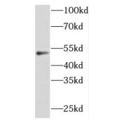 WB analysis of HeLa cells, using FOXP3 antibody (1/1000 dilution).