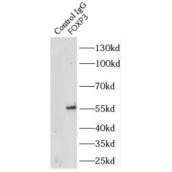 Forkhead Box Protein P3 (FOXP3) Antibody