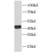 WB analysis of mouse kidney tissue, using FOXQ1 antibody (1/800 dilution).