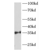 WB analysis of fetal human brain tissue, using FOXR1 antibody (1/600 dilution).