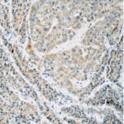 FRAS1-Related Extracellular Matrix Protein 1 (FREM1) Antibody