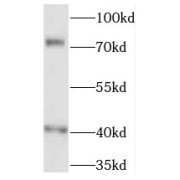 WB analysis of human plasma tissue, using FREM1 antibody (1/300 dilution).