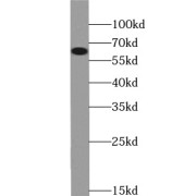 WB analysis of MCF-7 cells, using FRS2 antibody (1/1000 dilution).