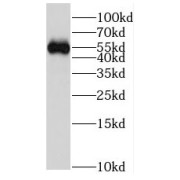 WB analysis of human placenta tissue, using FRS3 antibody (1/500 dilution).