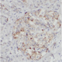 Secreted Frizzled-Related Protein 3 (FRZB) Antibody