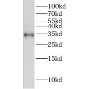 WB analysis of human heart tissue, using FRZB antibody (1/1500 dilution).