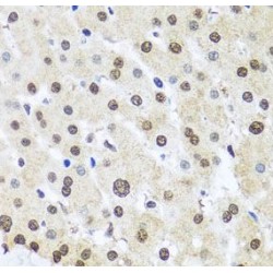 Far Upstream Element (FUSE) Binding Protein 1 (FUBP1) Antibody