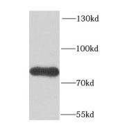 WB analysis of mouse brain tissue, using FUBP1 antibody (1/1000 dilution).