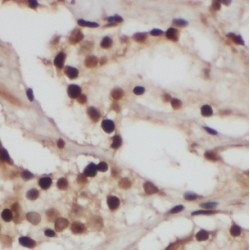 Far Upstream Element (FUSE) Binding Protein 3 (FUBP3) Antibody