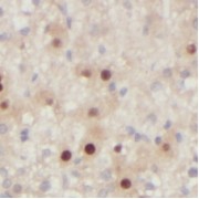 IHC-P analysis of human liver tissue, using FUCA1 antibody (1/50 dilution).