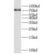 WB analysis of HEK-293 cells, using FUS/TLS antibody (1/2000 dilution).