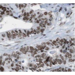 FUS / TLS Antibody