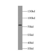 WB analysis of K-562 cells, using FUS antibody (1/1000 dilution).