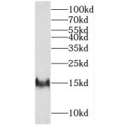 WB analysis of K562 cells, using FXN antibody (1/1000 dilution).