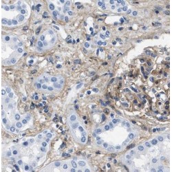 Fragile X Mental Retardation, Autosomal Homolog 1 (FXR1) Antibody