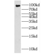 WB analysis of HeLa cells, using FXR2 antibody (1/500 dilution).