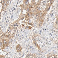 FXYD Domain Containing Ion Transport Regulator 2 (FXYD2) Antibody