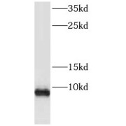 WB analysis of COLO 320 cells, using FXYD3 antibody (1/400 dilution).