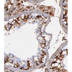 FXYD Domain Containing Ion Transport Regulator 4 (FXYD4) Antibody