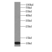 WB analysis of HEK-293 cells, using FXYD4 antibody (1/500 dilution).