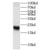 WB analysis of mouse brain tissue, using FXYD7 antibody (1/600 dilution).