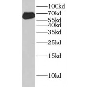 WB analysis of COLO 320 cells, using FZD5 antibody (1/600 dilution).