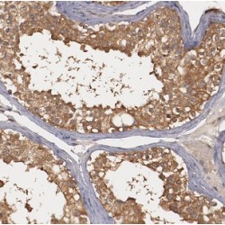 GTPase Activating Protein (SH3 Domain) Binding Protein 1 (G3BP1) Antibody