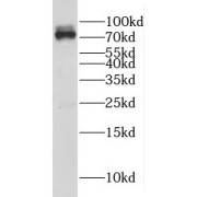 WB analysis of MCF-7 cells, using GAB2 antibody (1/600 dilution).