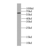 WB analysis of mouse brain tissue, using GAB3-Specific antibody (1/500 dilution).