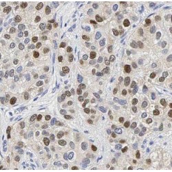 GA Binding Protein Alpha Chain (GABPA) Antibody