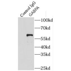 GA Binding Protein Alpha Chain (GABPA) Antibody