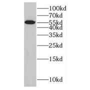 WB analysis of K-562 cells, using GABPA antibody (1/1000 dilution).