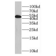 WB analysis of Jurkat cells, using GABPB2 antibody (1/500 dilution).