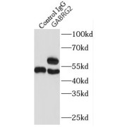 IP analysis of mouse brain tissue lysate (4000 µg), using GABRG2 antibody (4 µg, detection: 1/500 dilution).