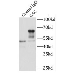 GAC-specific Antibody