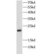 WB analysis of MCF7 cells, using GADD45A antibody (1/1000 dilution).