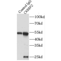 Growth Arrest And DNA Damage-Inducible, Gamma Interacting Protein 1 (GADD45GIP1) Antibody