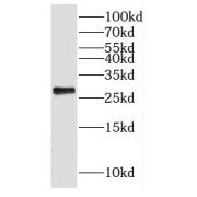 WB analysis of mouse heart tissue, using GADD45GIP1 antibody (1/300 dilution).