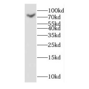 WB analysis of Transfected HEK-293 cells, using GAGE7 antibody (1/700 dilution).