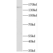 WB analysis of human brain tissue, using GAK antibody (1/500 dilution).