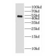 WB analysis of mouse brain tissue, using GAL3ST3 antibody (1/600 dilution).