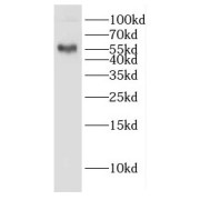 WB analysis of human placenta tissue, using GAL3ST4 antibody (1/500 dilution).