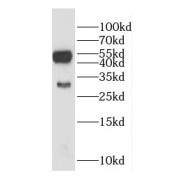 WB analysis of mouse brain tissue, using Galc antibody (1/300 dilution).