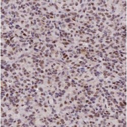 UDP-Glucose 4-Epimerase (GALE) Antibody