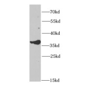 WB analysis of A375 cells, using GALE antibody (1/1000 dilution).