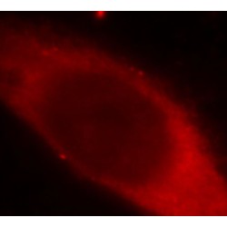 Galectin 3 (LGALS3) Antibody