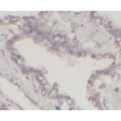 Galectin 3 (LGALS3) Antibody